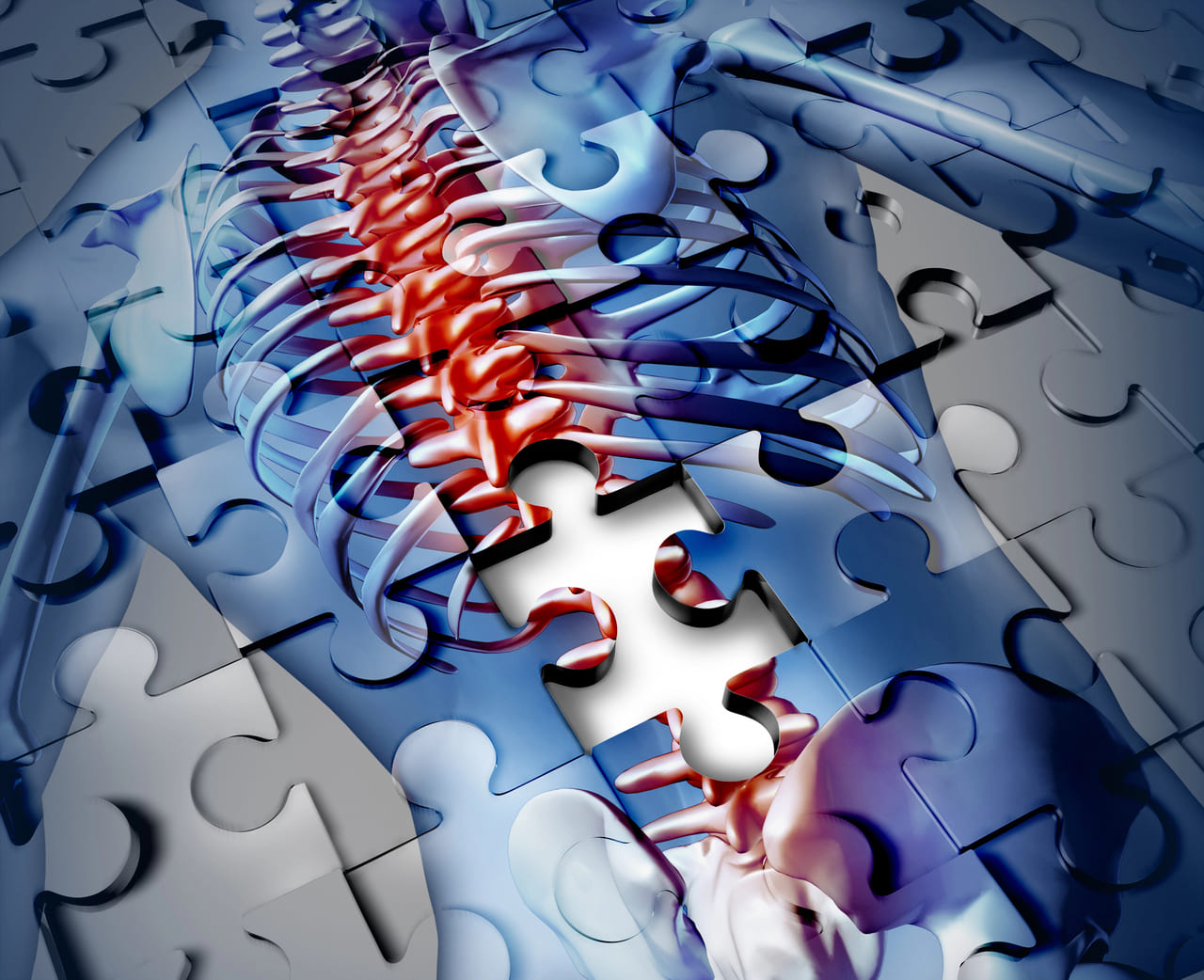 osteoporosis physiotherapy guide